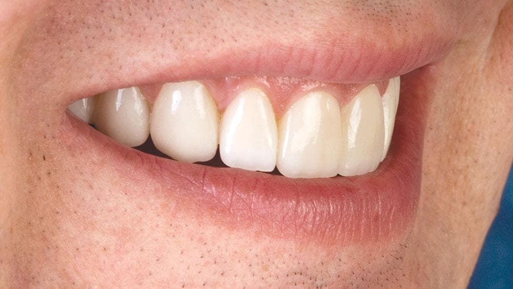 Estética Dental